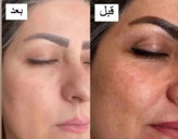 خرید پک ضد لک لاکچری کوین اصل لاکچری کوین و بیز - فروشگاه زیبایی با بیتا